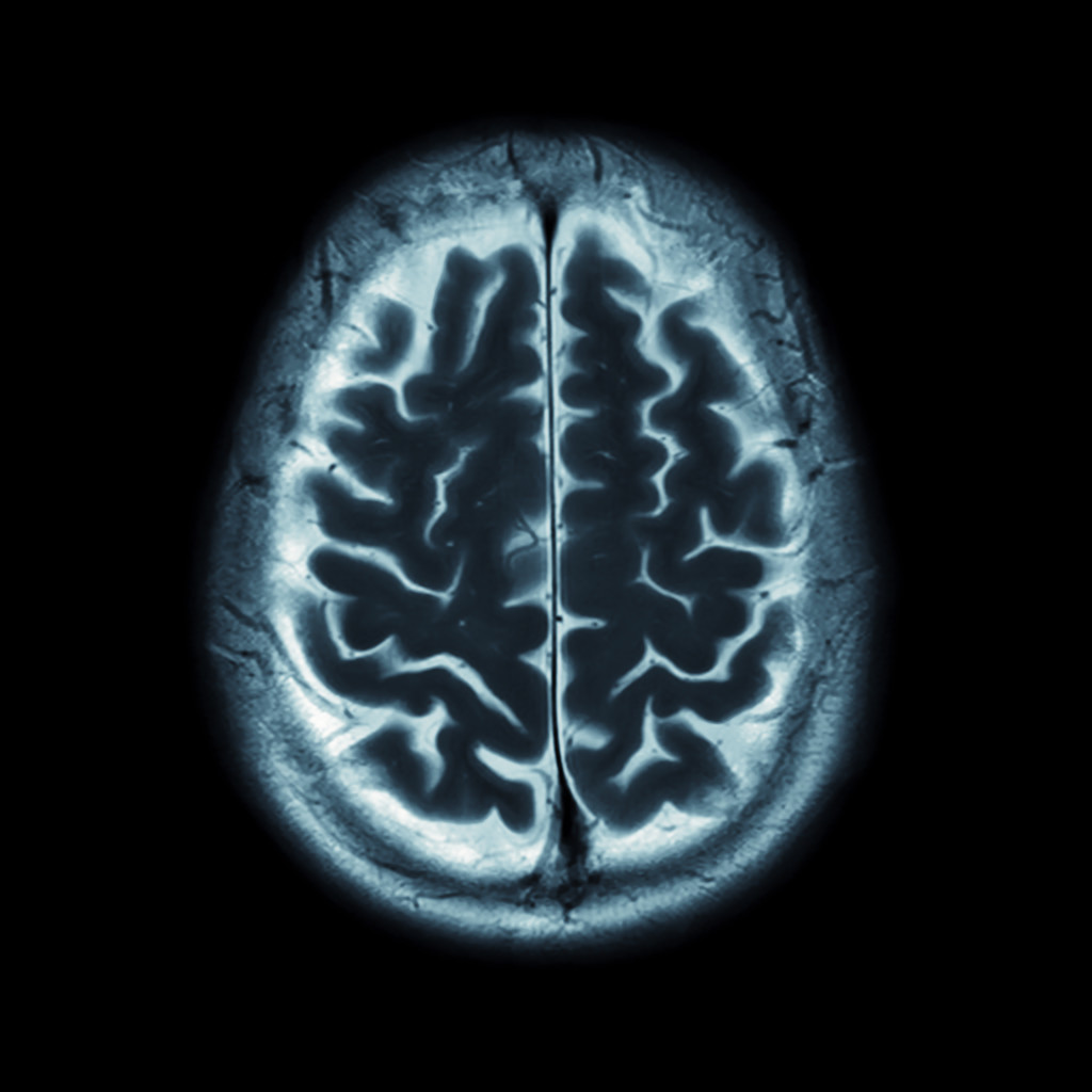 iStock_000050359850_Double iStock_000050359850_Double